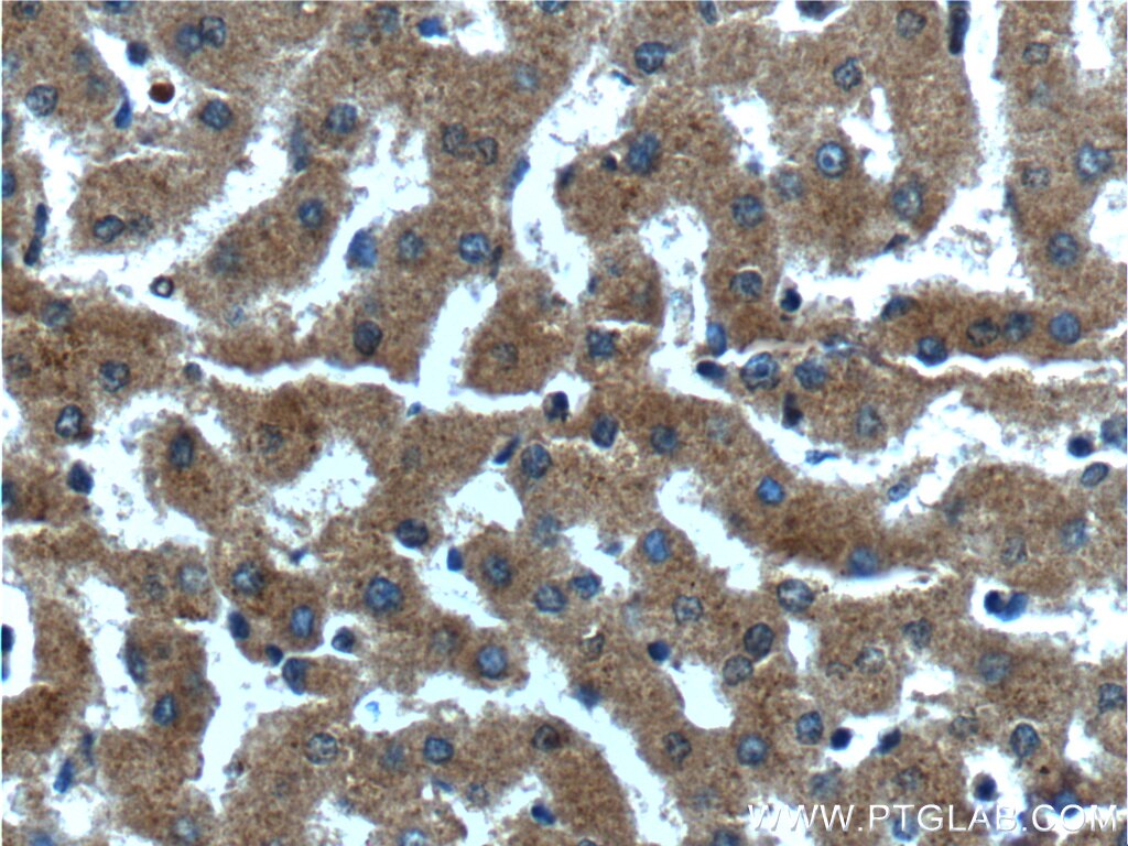 Immunohistochemistry (IHC) staining of human liver tissue using CXCL14 Polyclonal antibody (10468-1-AP)