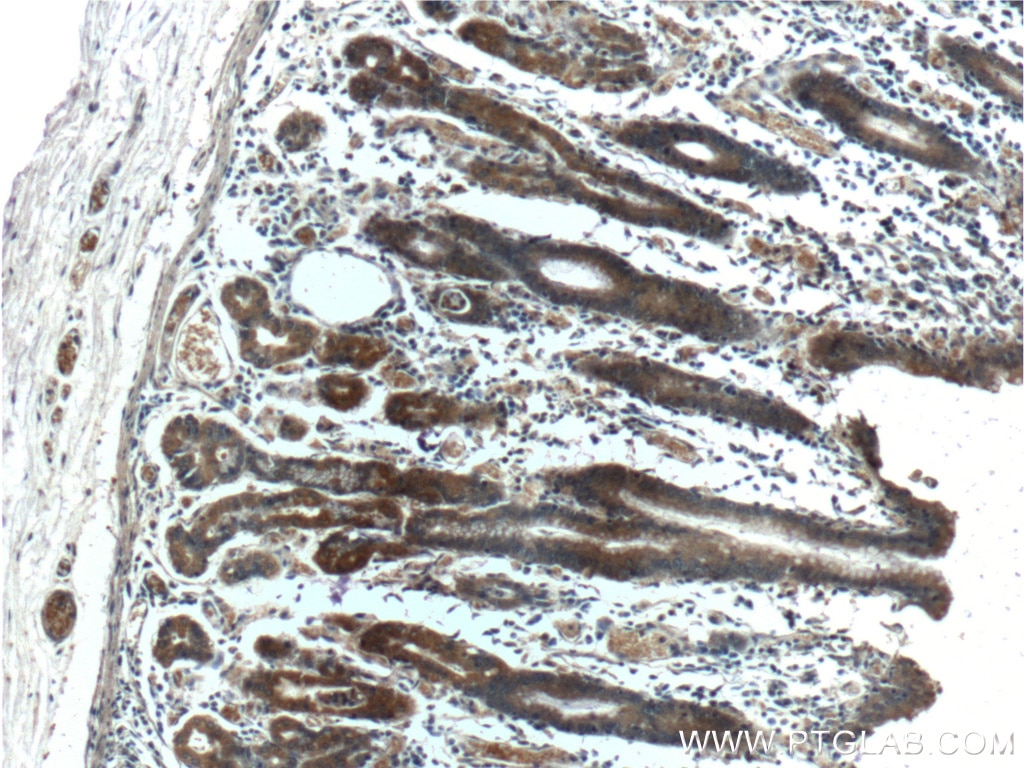 Immunohistochemistry (IHC) staining of human stomach tissue using CXCL14 Polyclonal antibody (10468-1-AP)
