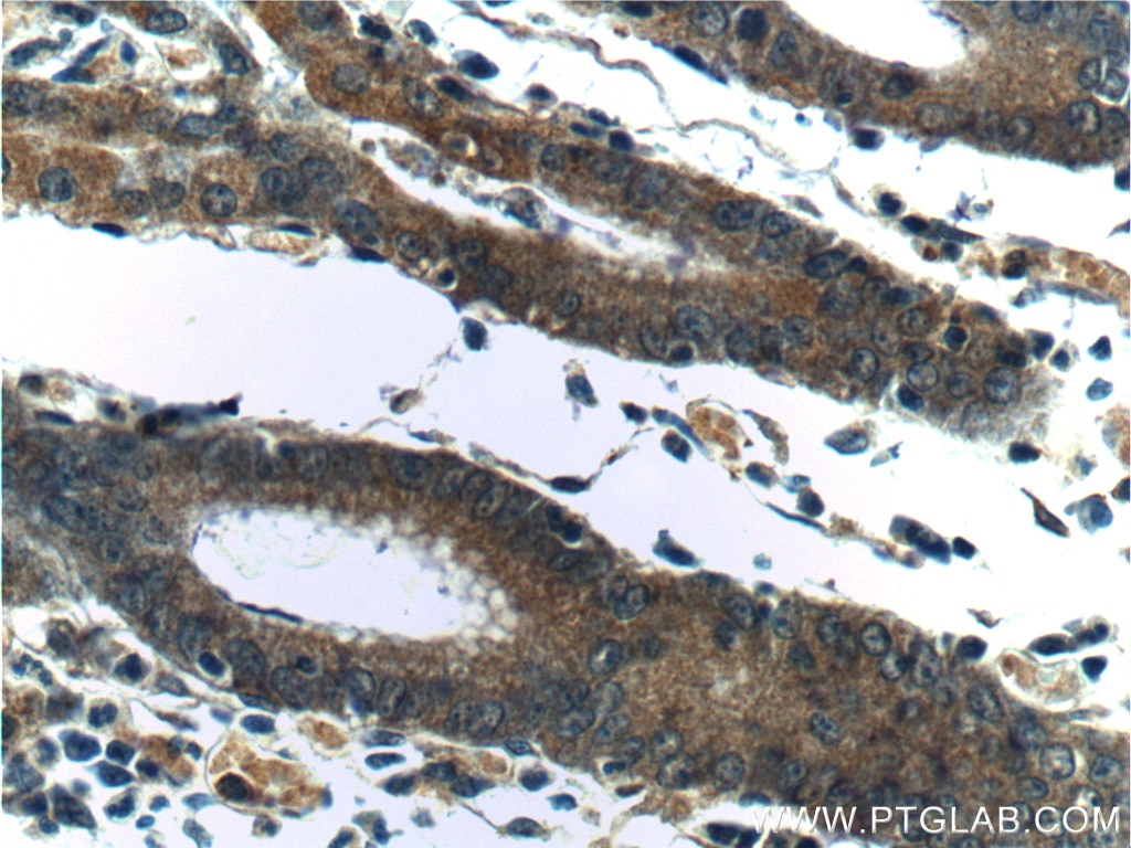 Immunohistochemistry (IHC) staining of human stomach tissue using CXCL14 Polyclonal antibody (10468-1-AP)