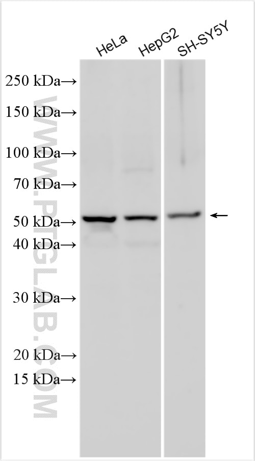 Western Blot (WB) analysis of various lysates using CXCL16 Polyclonal antibody (29589-1-AP)