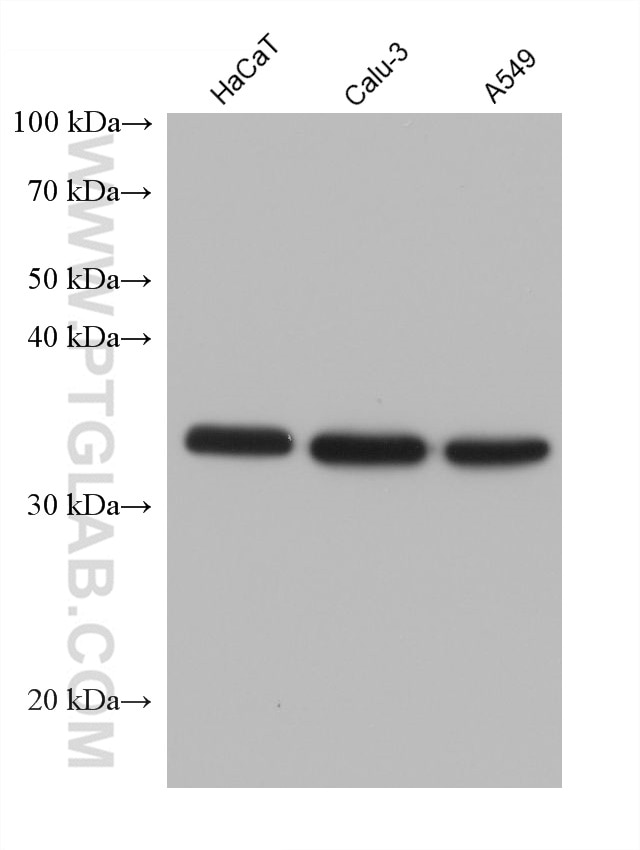 Western Blot (WB) analysis of various lysates using CXCL16 Monoclonal antibody (60123-1-Ig)