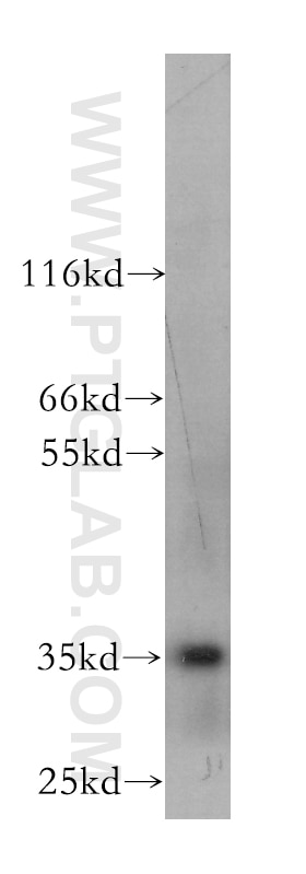 Western Blot (WB) analysis of SH-SY5Y cells using CXCL16 Monoclonal antibody (60123-1-Ig)