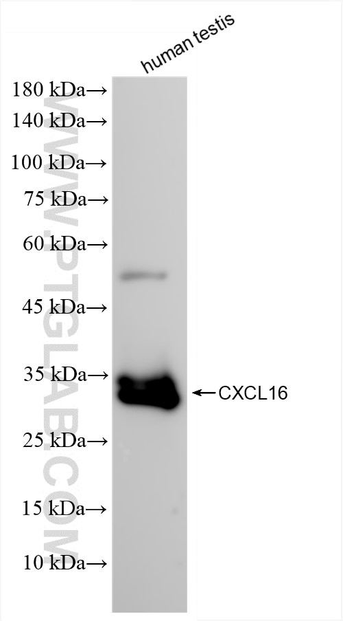 CXCL16