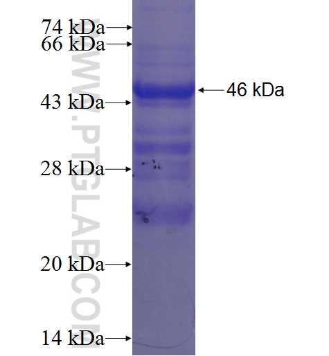 CXCL16 fusion protein Ag4872 SDS-PAGE