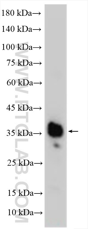 WB analysis of Recombinant protein using 16325-1-AP Western Blot (WB) analysis of Recombinant protein using CXCL2 Polyclonal antibody (16325-1-AP)