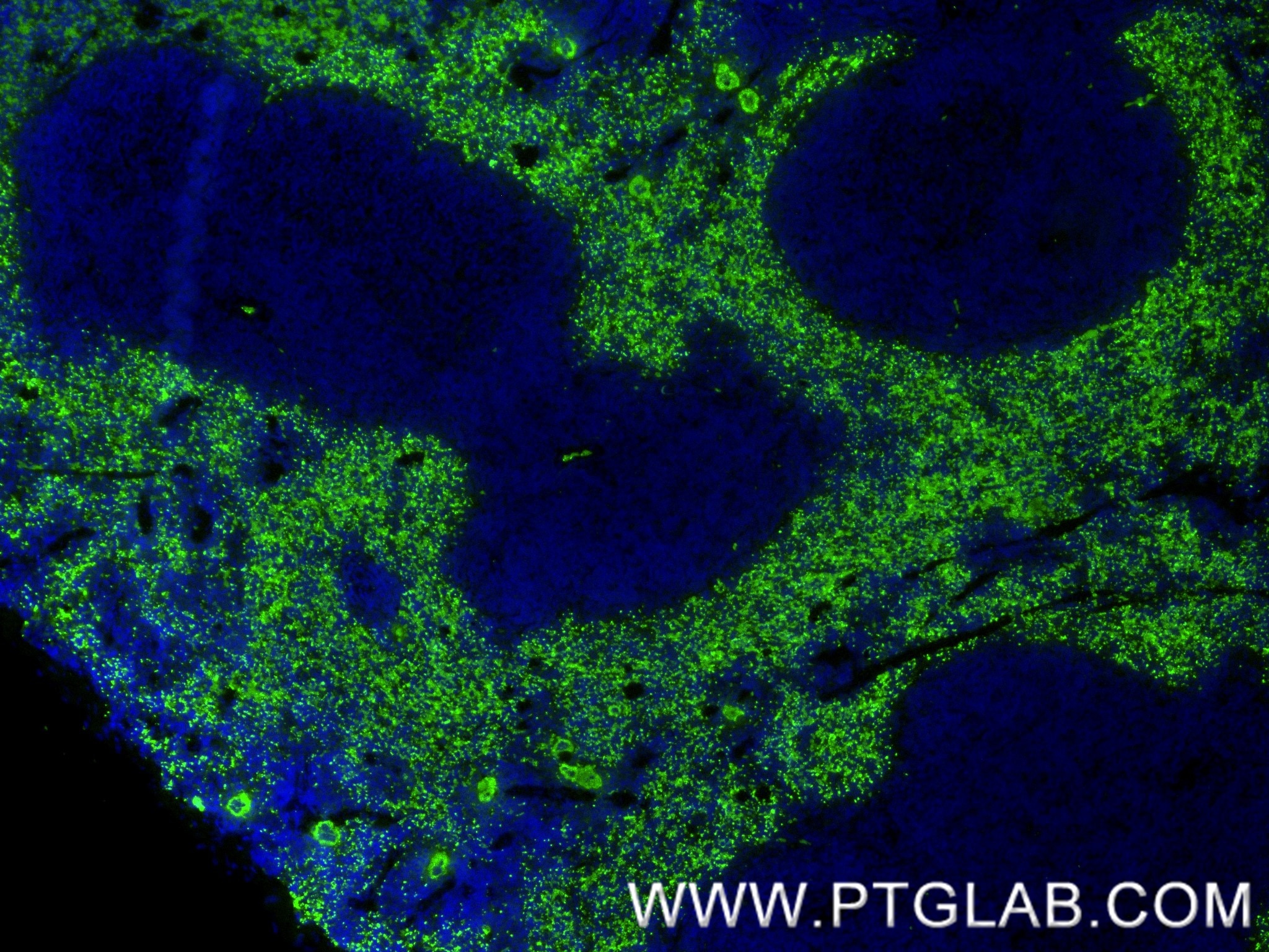Immunofluorescence (IF) / fluorescent staining of mouse spleen tissue using CXCL4/PF4 Recombinant monoclonal antibody (85738-1-RR)