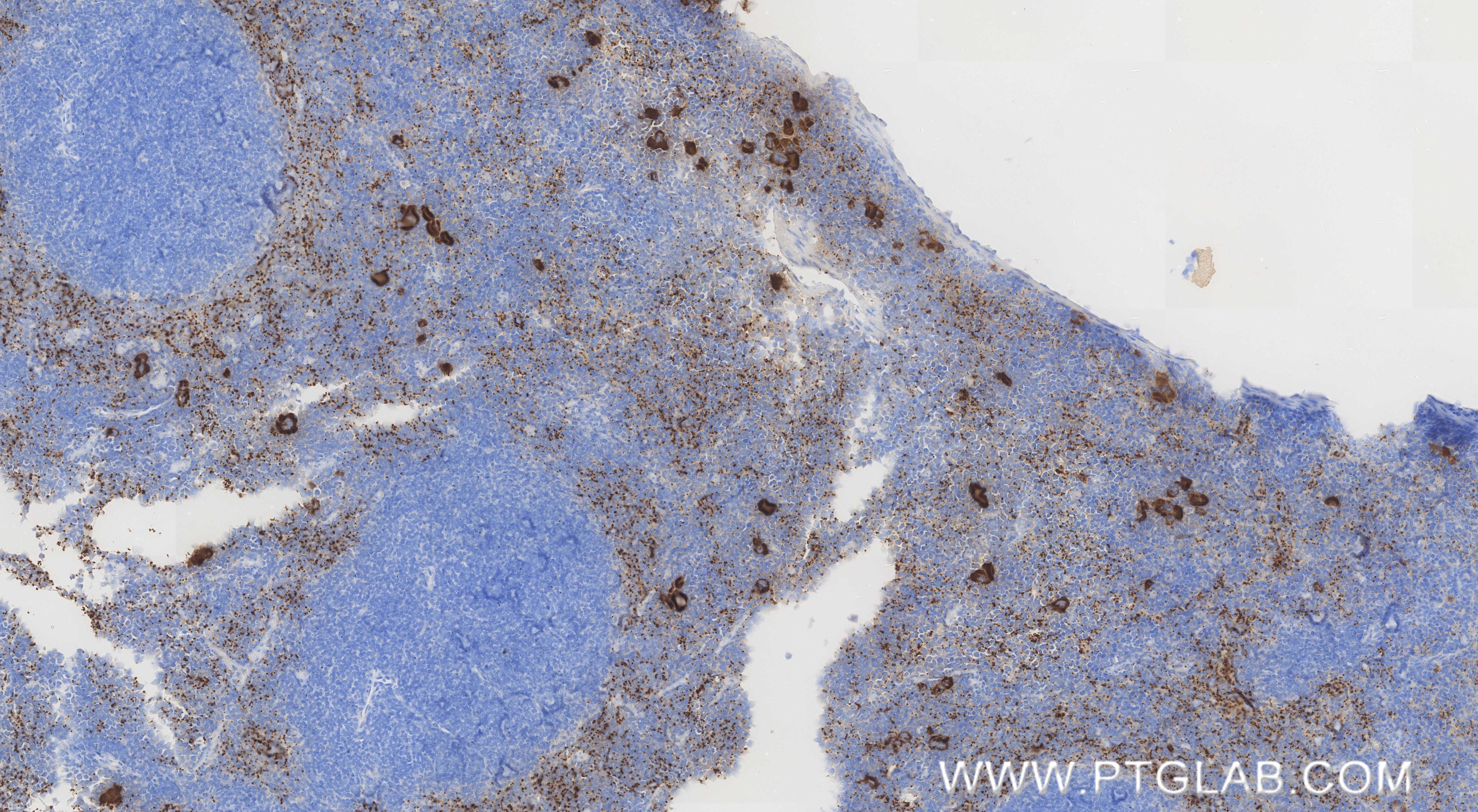 Immunohistochemistry (IHC) staining of mouse spleen tissue using CXCL4/PF4 Recombinant monoclonal antibody (85738-1-RR)