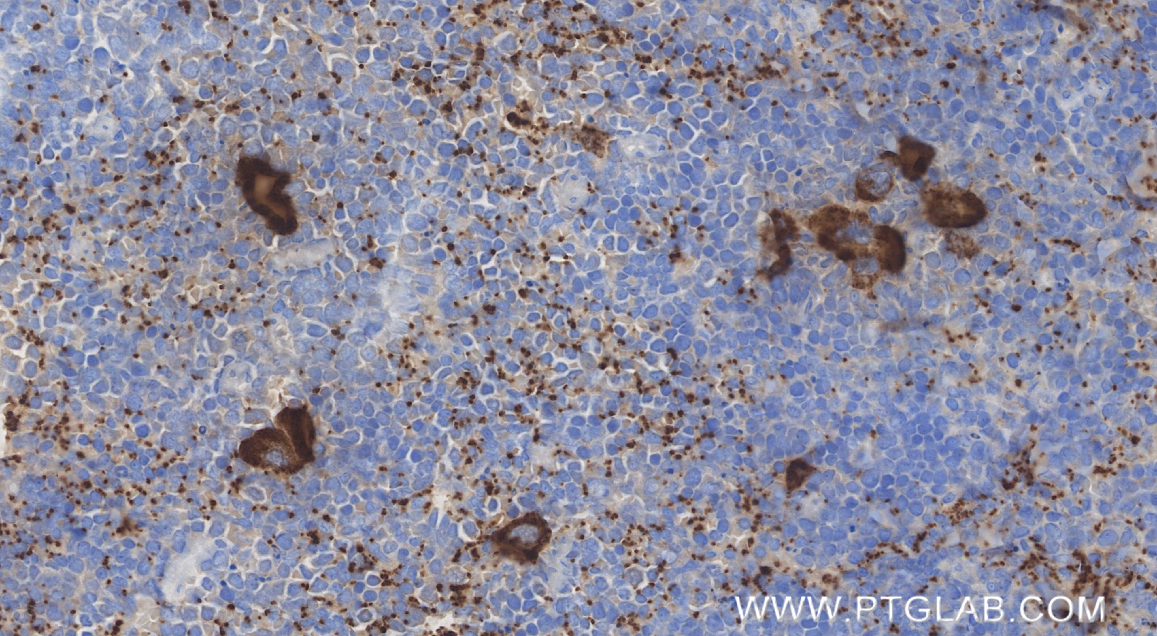 Immunohistochemistry (IHC) staining of mouse spleen tissue using CXCL4/PF4 Recombinant monoclonal antibody (85738-1-RR)