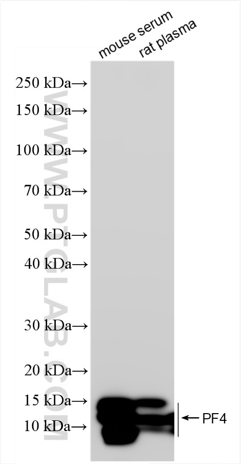 Western Blot (WB) analysis of various lysates using CXCL4/PF4 Recombinant antibody (85738-1-RR)