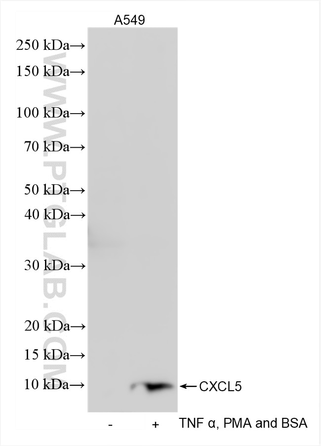 CXCL5
