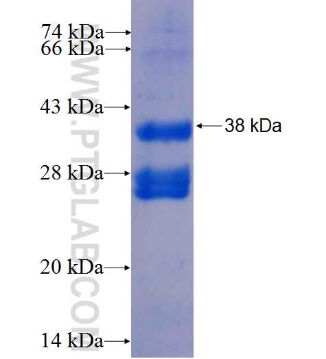 CXCL5 fusion protein Ag1079 SDS-PAGE
