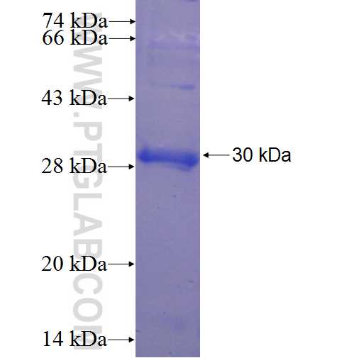 CXCL6 fusion protein Ag24132 SDS-PAGE