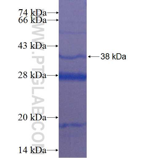 CXCL6 fusion protein Ag3300 SDS-PAGE
