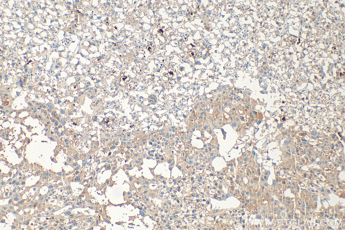 Immunohistochemistry (IHC) staining of mouse placenta tissue using CXCL7/PPBP Polyclonal antibody (33296-1-AP)
