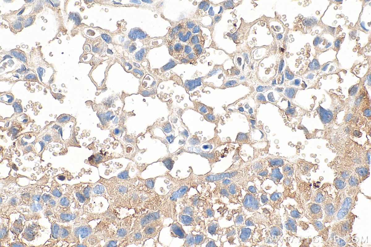 Immunohistochemistry (IHC) staining of mouse placenta tissue using CXCL7/PPBP Polyclonal antibody (33296-1-AP)