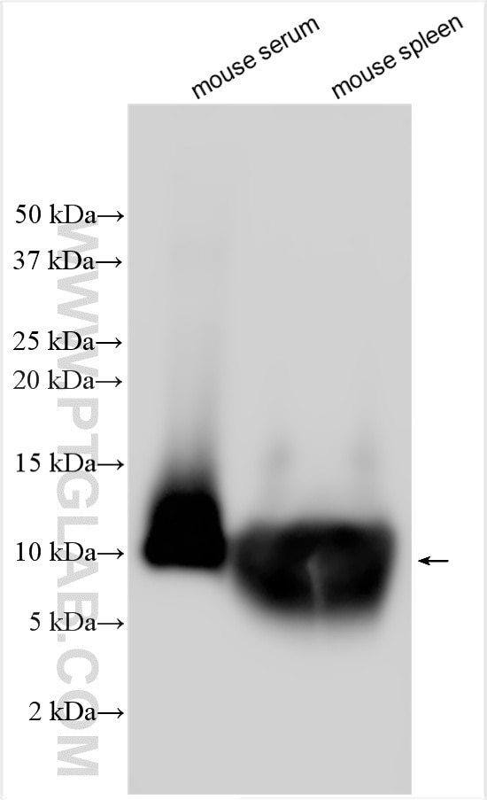 Western Blot (WB) analysis of various lysates using CXCL7/PPBP Polyclonal antibody (33296-1-AP)