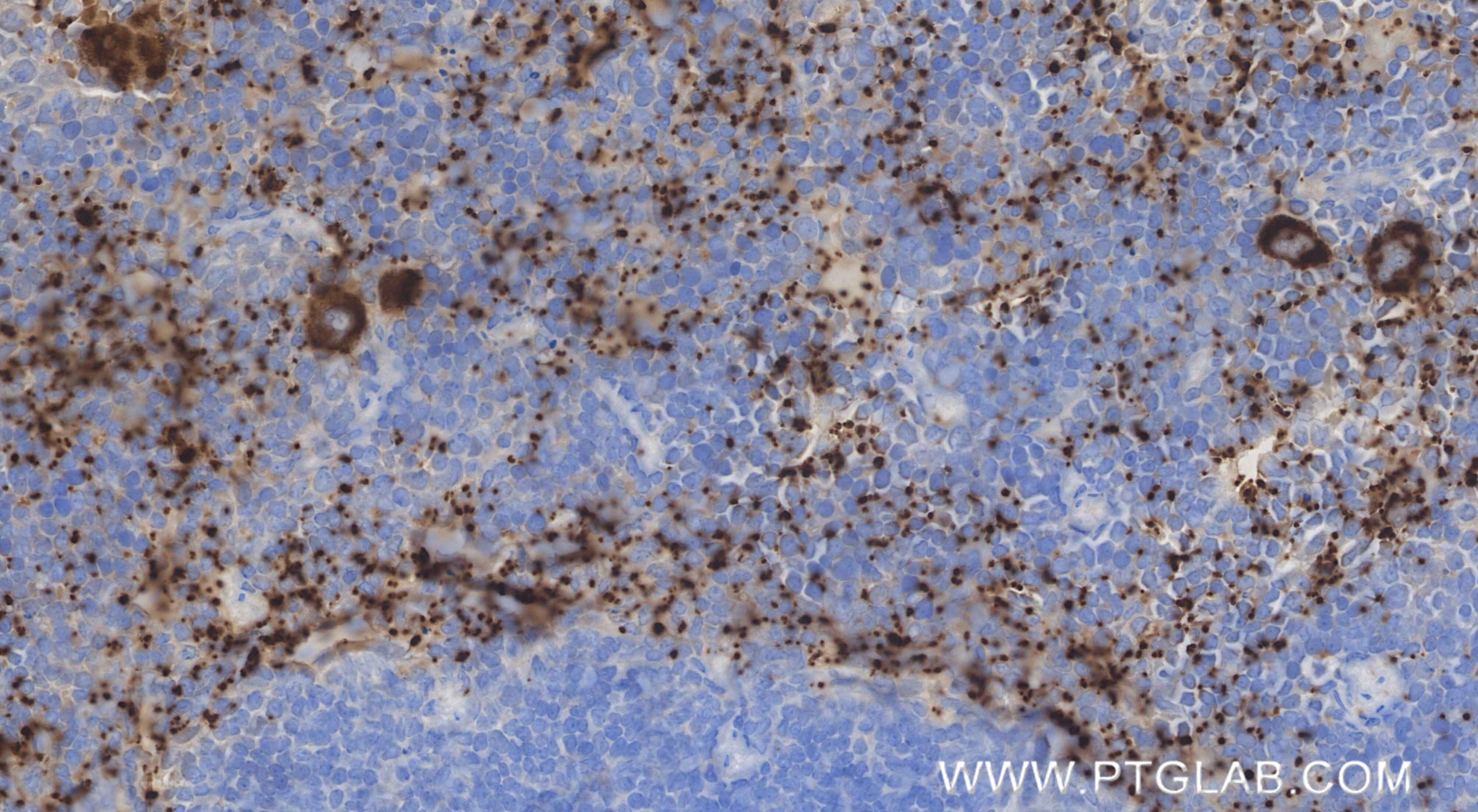 Immunohistochemistry (IHC) staining of mouse spleen tissue using CXCL7/PPBP Recombinant monoclonal antibody (86907-3-RR)