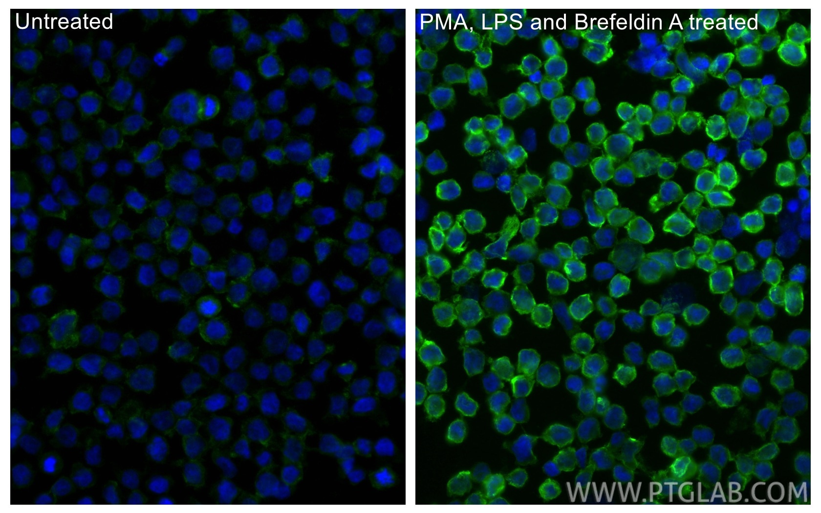 Immunofluorescence (IF) / fluorescent staining of THP-1 cells using CXCL8/IL-8 Polyclonal antibody (17038-1-AP)