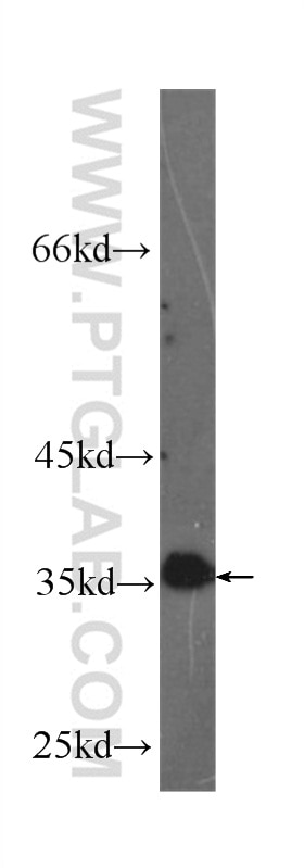 CXCL8/IL-8 Monoclonal antibody