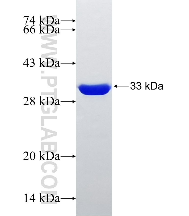 CXCL8/IL-8 fusion protein Ag25640 SDS-PAGE