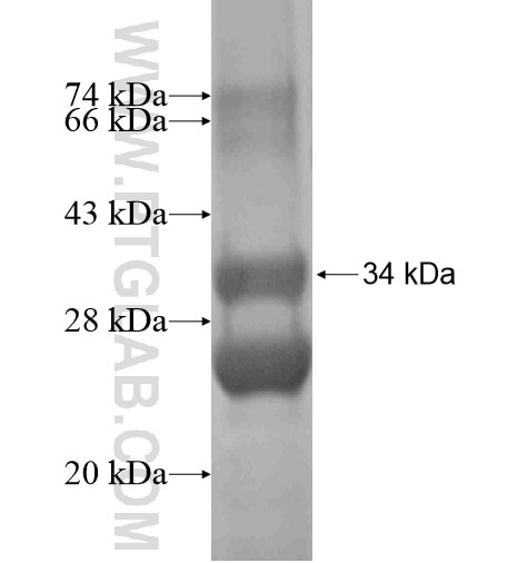 CXCL8/IL-8 fusion protein Ag10552 SDS-PAGE