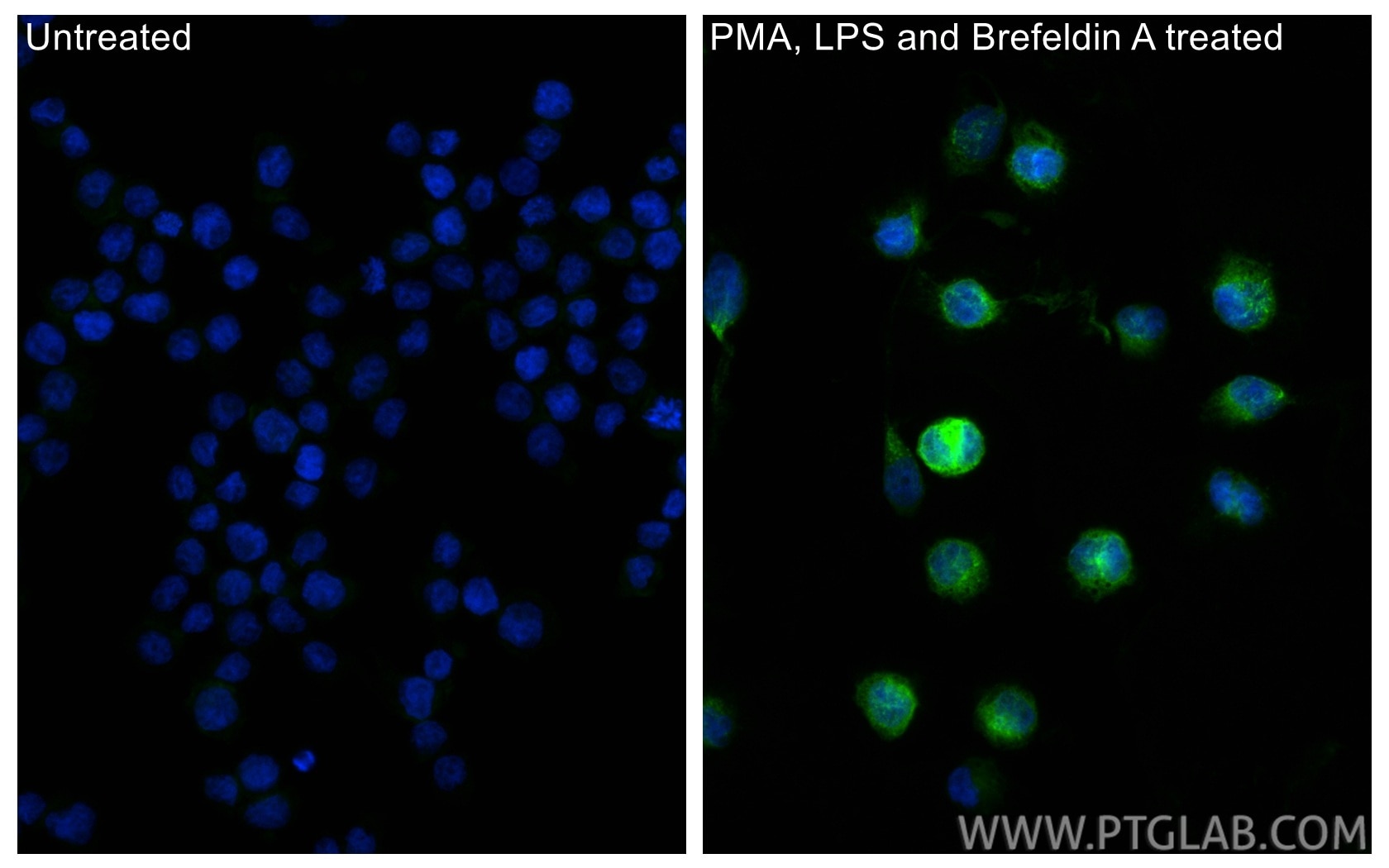 Immunofluorescence (IF) / fluorescent staining of THP-1 cells using CXCL8/IL-8 Polyclonal antibody (31533-1-AP)