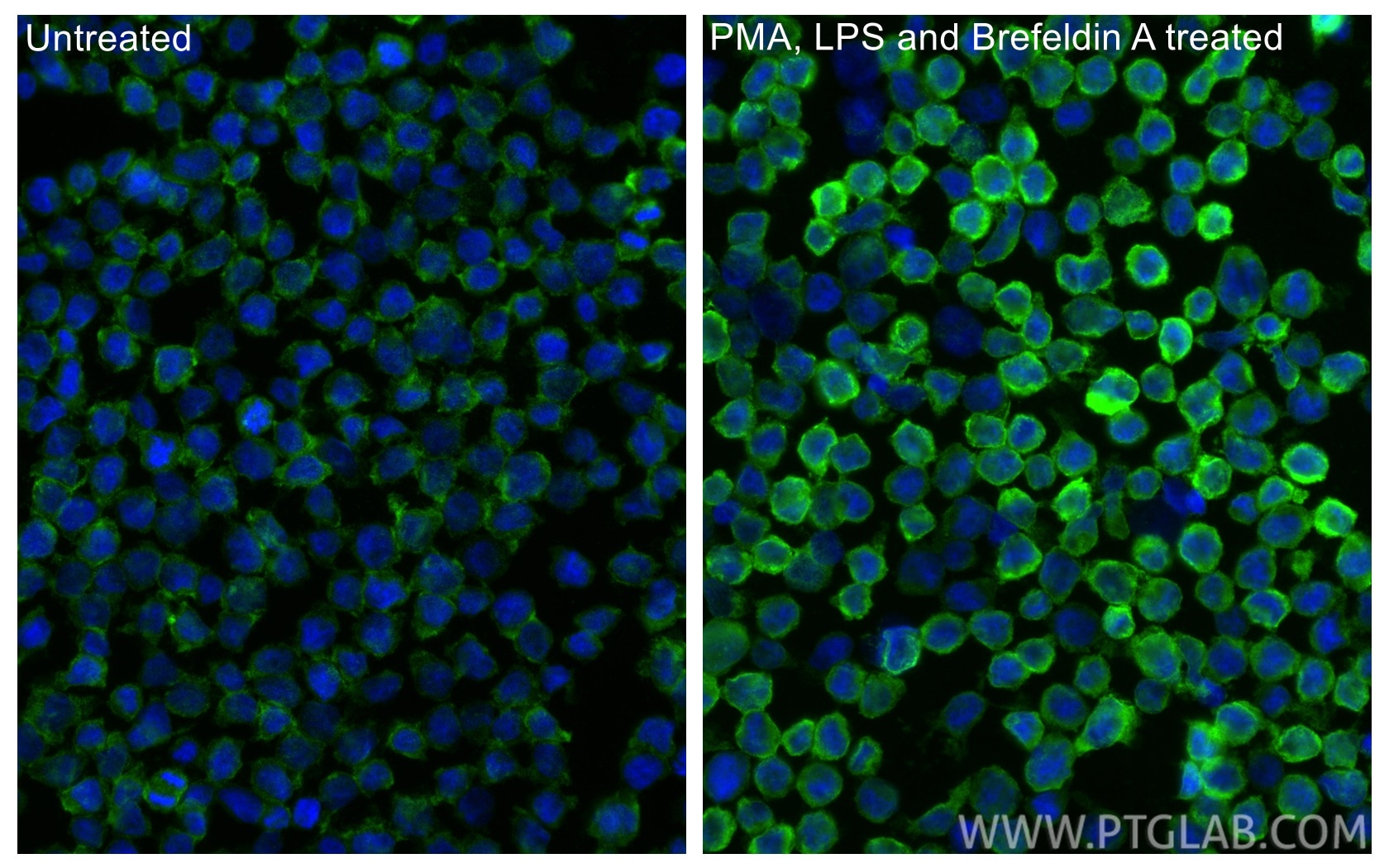 Immunofluorescence (IF) / fluorescent staining of THP-1 cells using CXCL8/IL-8 Polyclonal antibody (27095-1-AP)