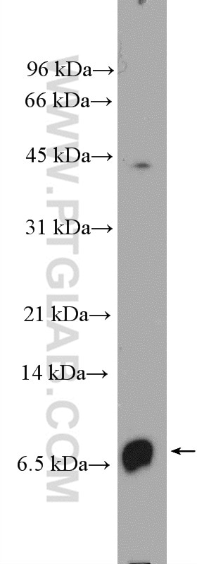 CXCL8/IL-8