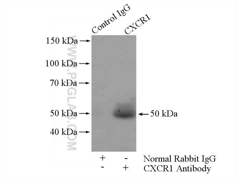 Immunoprecipitation (IP) experiment of Jurkat cells using CXCR1 Polyclonal antibody (55450-1-AP)