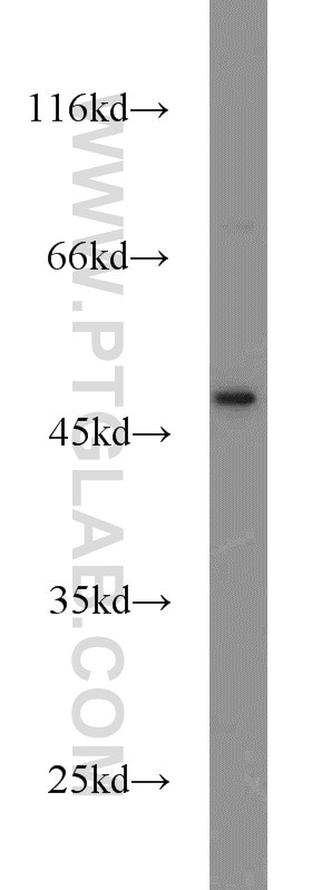 Western Blot (WB) analysis of Jurkat cells using CXCR1 Polyclonal antibody (55450-1-AP)