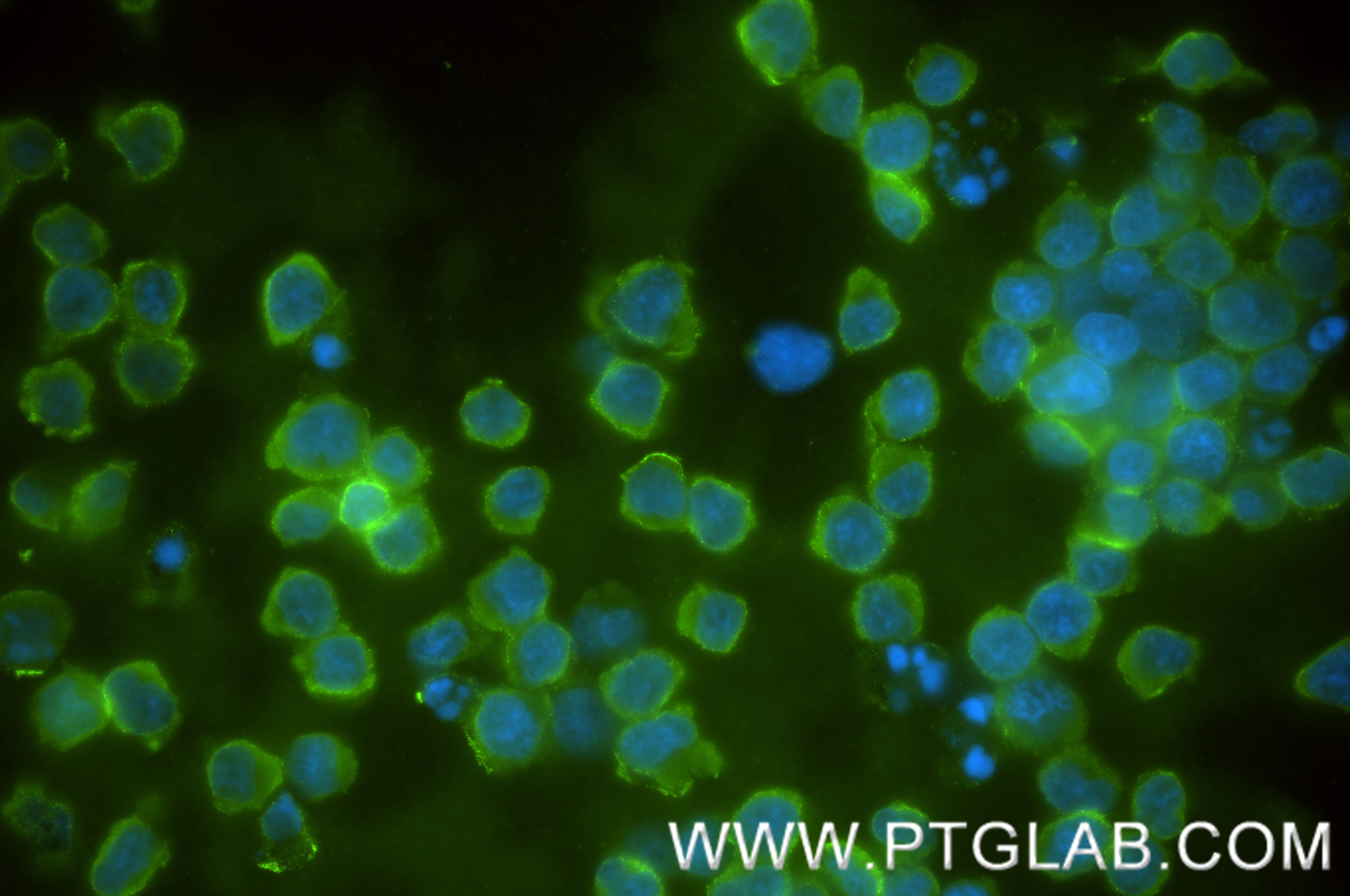 Immunofluorescence (IF) / fluorescent staining of Jurkat cells using CXCR1 Recombinant monoclonal antibody (83801-4-RR)