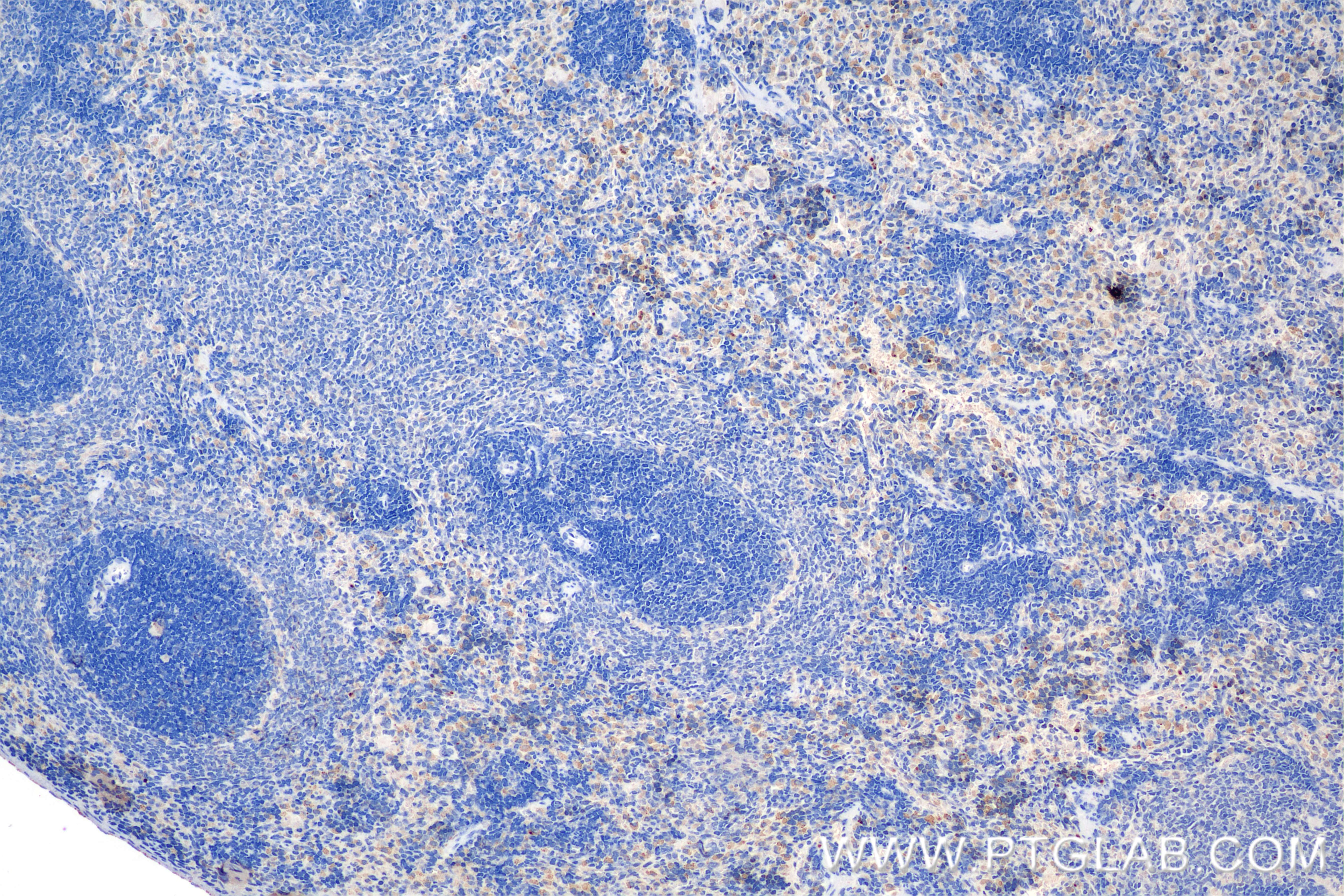 Immunohistochemistry (IHC) staining of rat spleen tissue using CXCR2 Recombinant antibody (85144-5-RR)