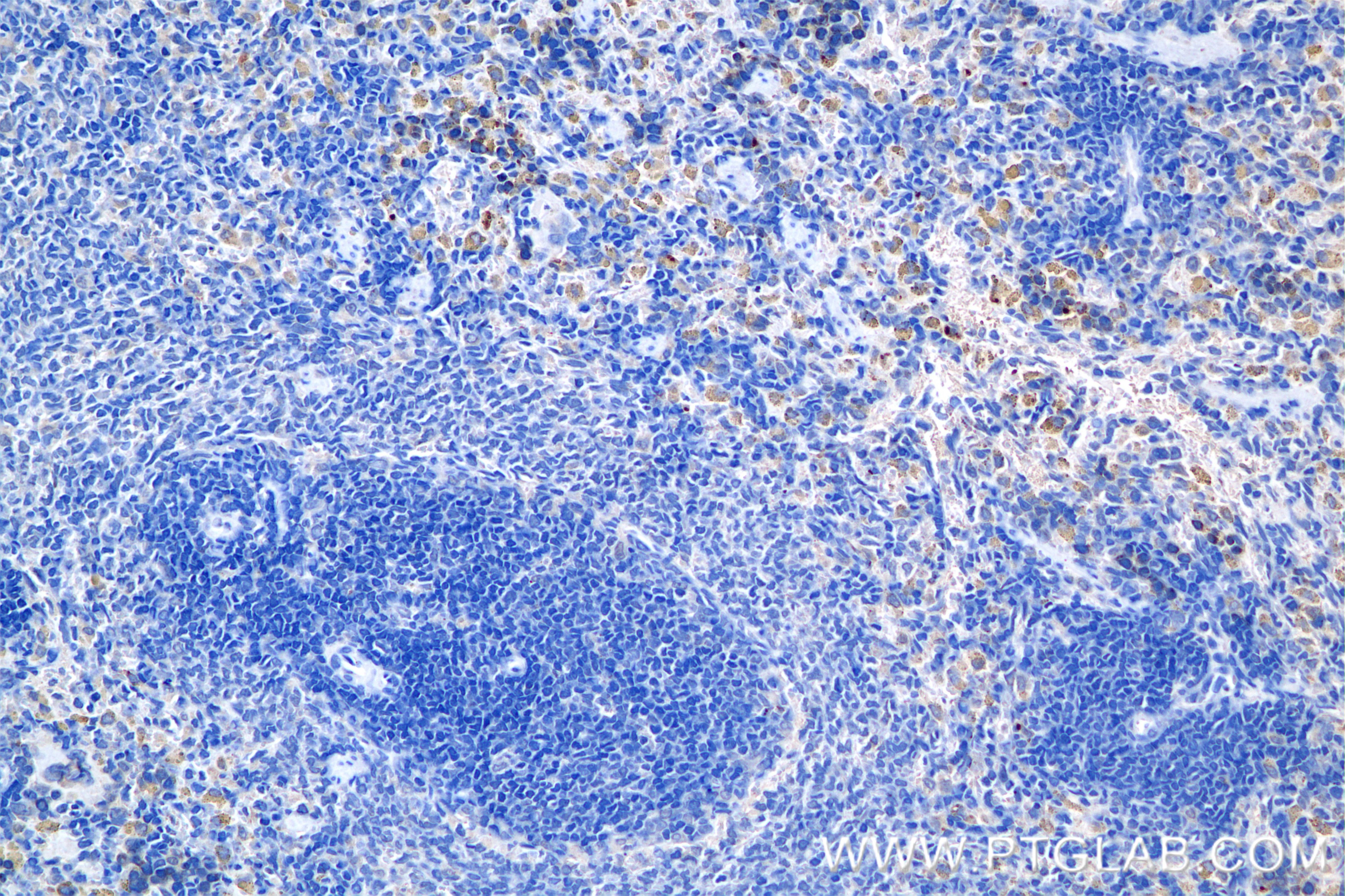 Immunohistochemistry (IHC) staining of rat spleen tissue using CXCR2 Recombinant antibody (85144-5-RR)