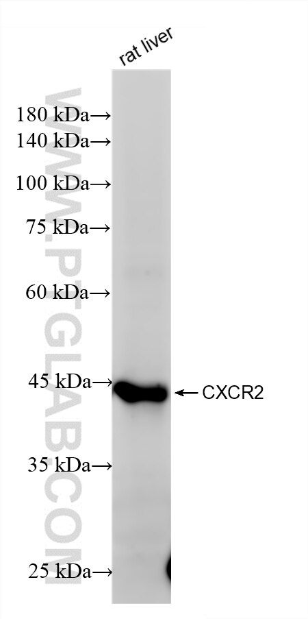Western Blot (WB) analysis of various lysates using CXCR2 Recombinant antibody (85144-5-RR)