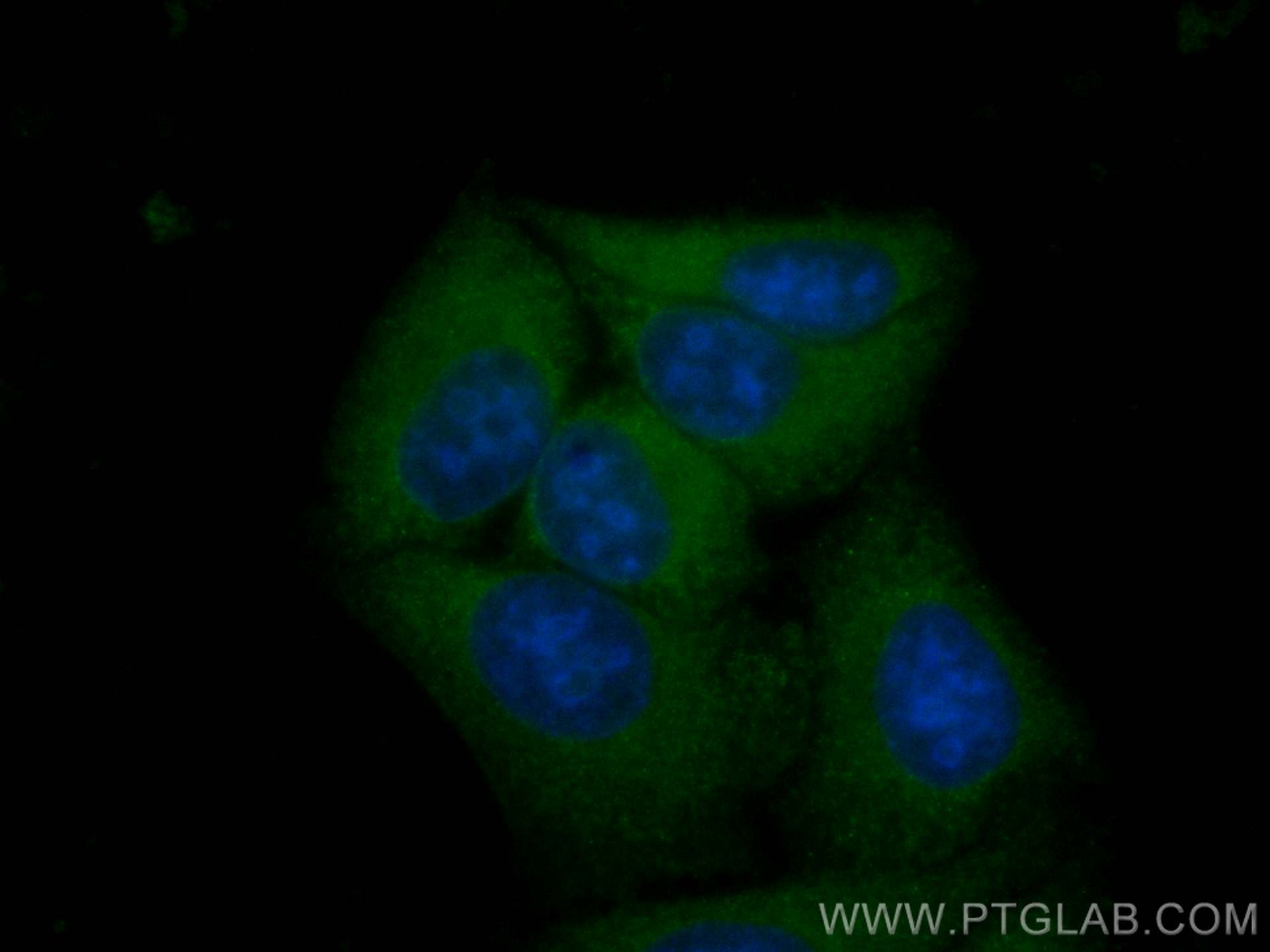 Immunofluorescence (IF) / fluorescent staining of HepG2 cells using CoraLite® Plus 488-conjugated CXCR2 Polyclonal ant (CL488-20634)