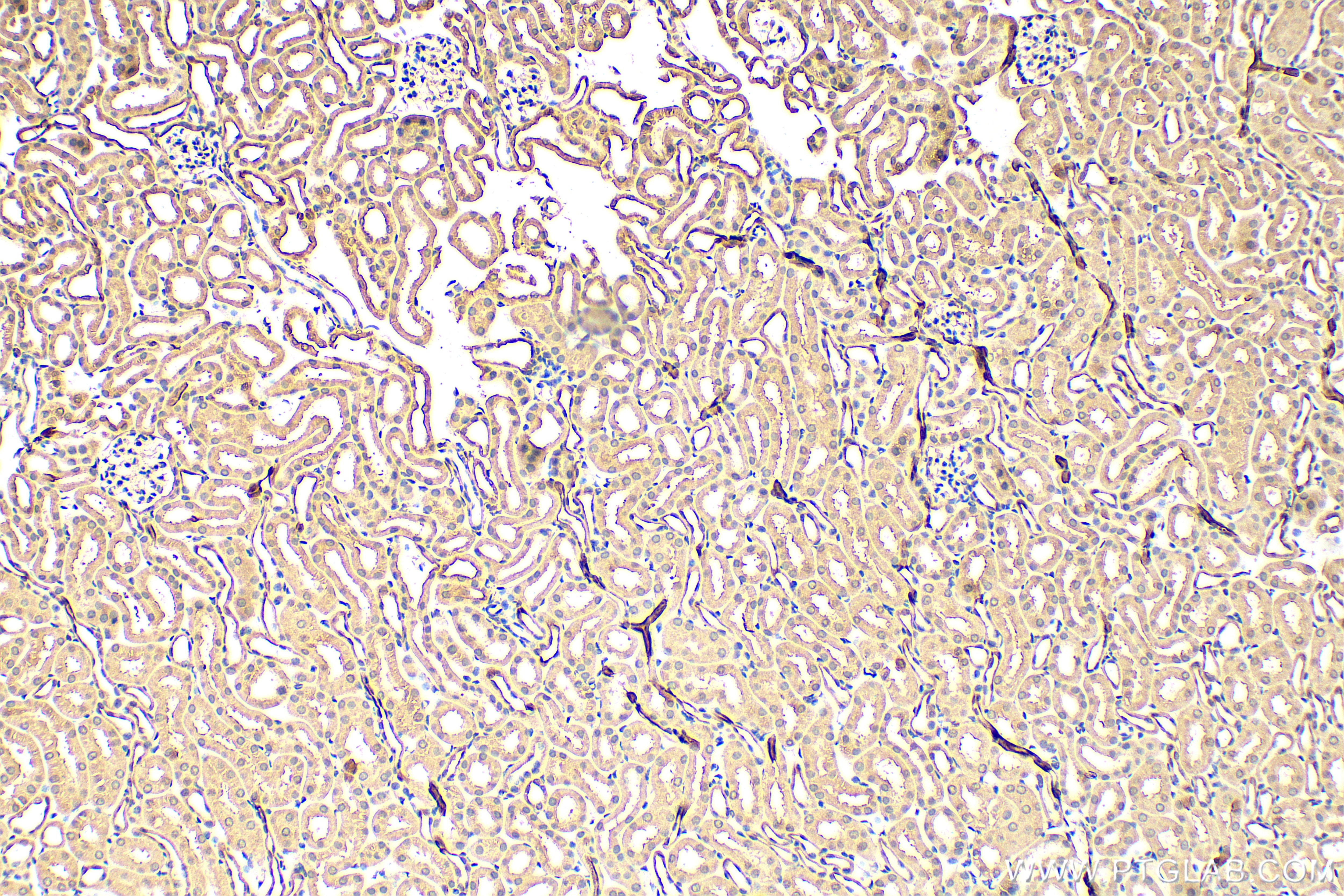 Immunohistochemistry (IHC) staining of mouse kidney tissue using CXCR3 Polyclonal antibody (26756-1-AP)