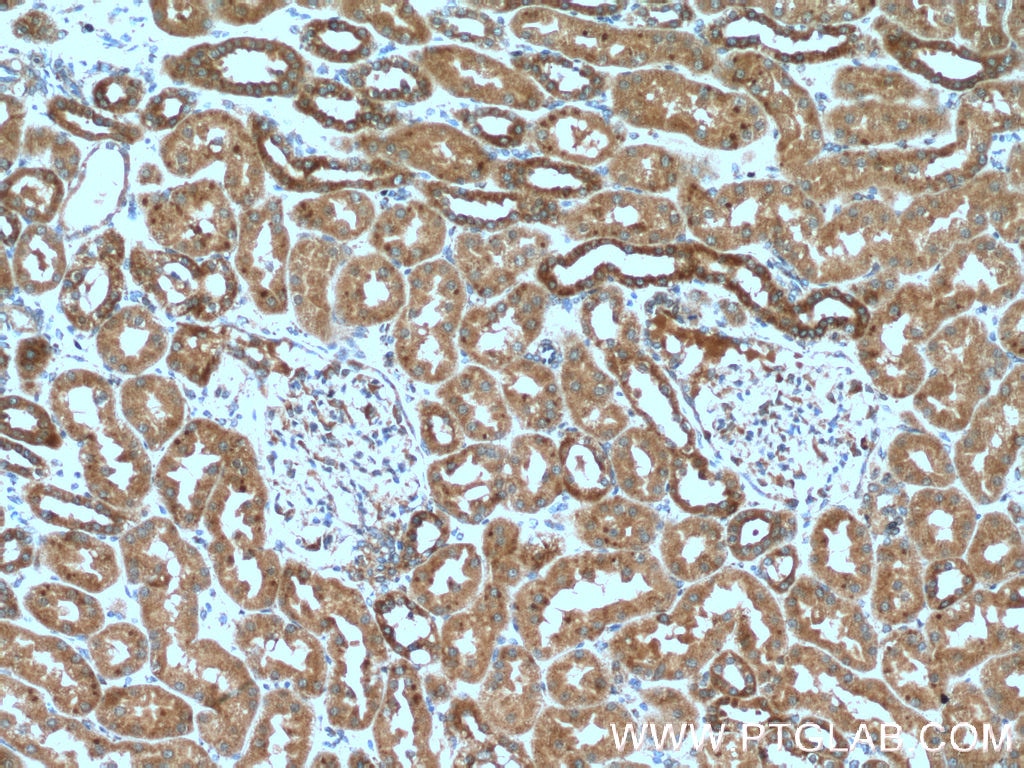 Immunohistochemistry (IHC) staining of human kidney tissue using CXCR3 Polyclonal antibody (26756-1-AP)