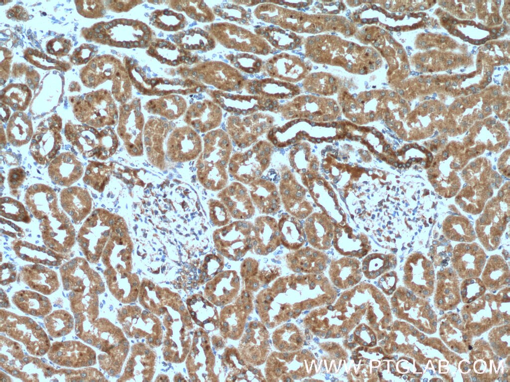 IHC staining of human kidney using 26756-1-AP