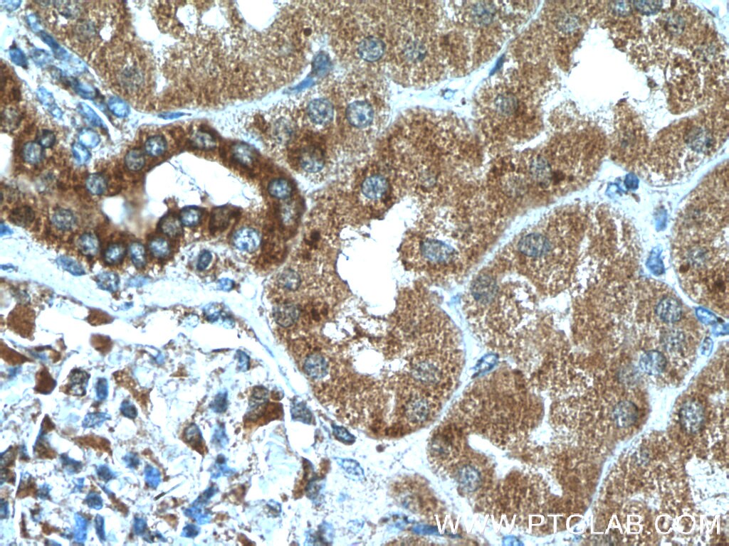 Immunohistochemistry (IHC) staining of human kidney tissue using CXCR3 Polyclonal antibody (26756-1-AP)