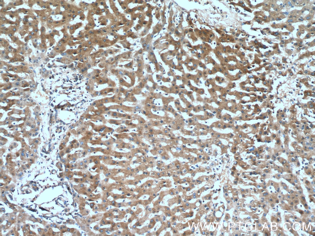 Immunohistochemistry (IHC) staining of human liver tissue using CXCR3 Polyclonal antibody (26756-1-AP)