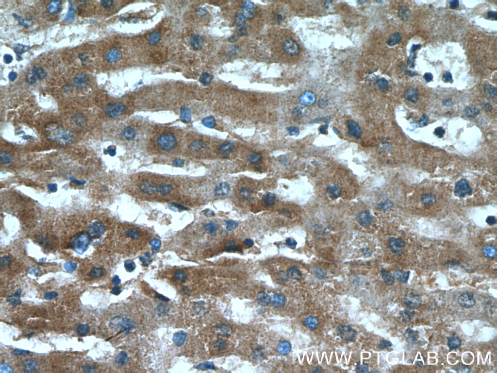 Immunohistochemistry (IHC) staining of human liver tissue using CXCR3 Polyclonal antibody (26756-1-AP)