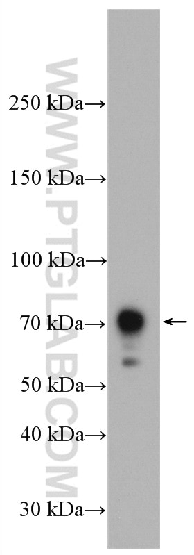 Western Blot (WB) analysis of mouse liver tissue using CXCR3 Polyclonal antibody (26756-1-AP)