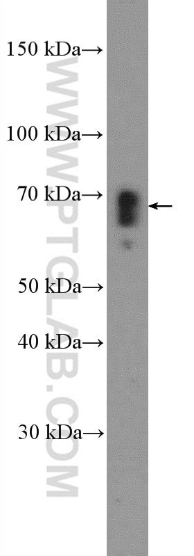 Western Blot (WB) analysis of Jurkat cells using CXCR3 Polyclonal antibody (26756-1-AP)