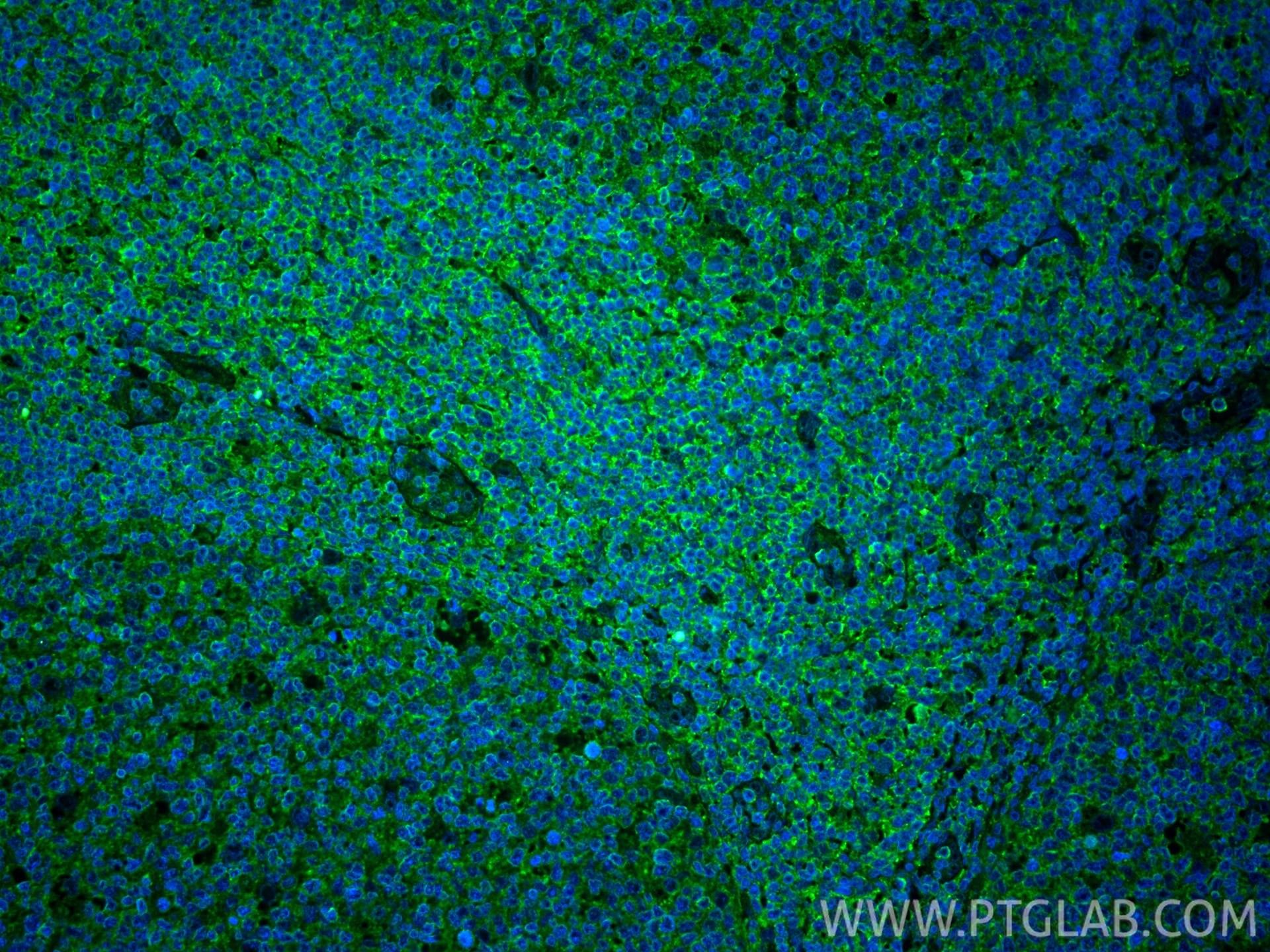Immunofluorescent analysis of (4% PFA) fixed paraffin-embedded human tonsillitis tissue using CXCR3B-specific antibody (60065-1-Ig, Clone: 1B2D6 ) at dilution of 1:400 and CoraLite®488-Conjugated Goat Anti-Mouse IgG(H+L) (SA00013-1). Heat mediated antigen retrieval with Tris-EDTA buffer (pH 9.0). Immunofluorescence (IF) / fluorescent staining of human tonsillitis tissue using CXCR3B-specific Monoclonal antibody (60065-1-Ig)