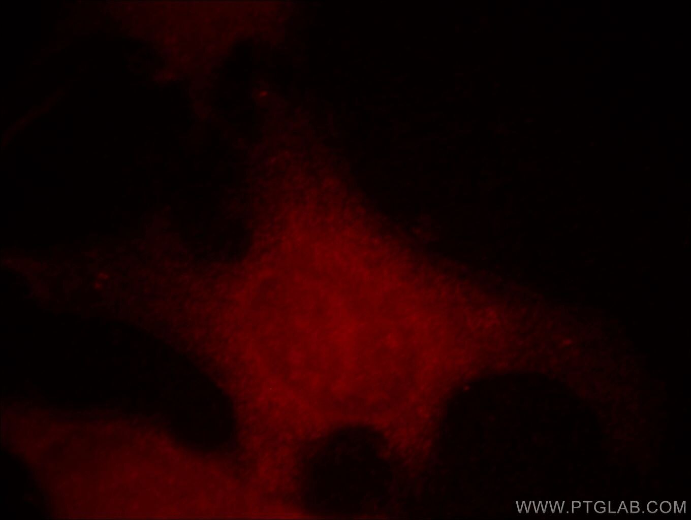 CXCR3B-specific