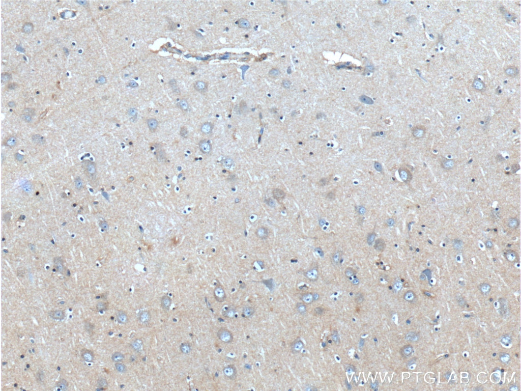 Immunohistochemistry (IHC) staining of human brain tissue using CXCR3B-specific Monoclonal antibody (60065-1-Ig)