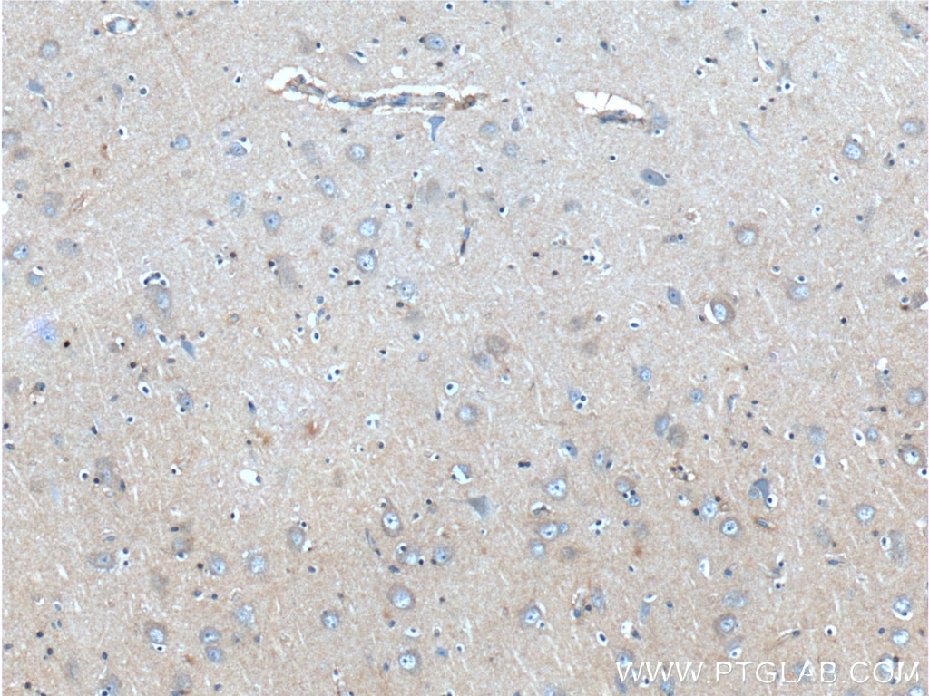 IHC staining of human brain using 60065-1-Ig