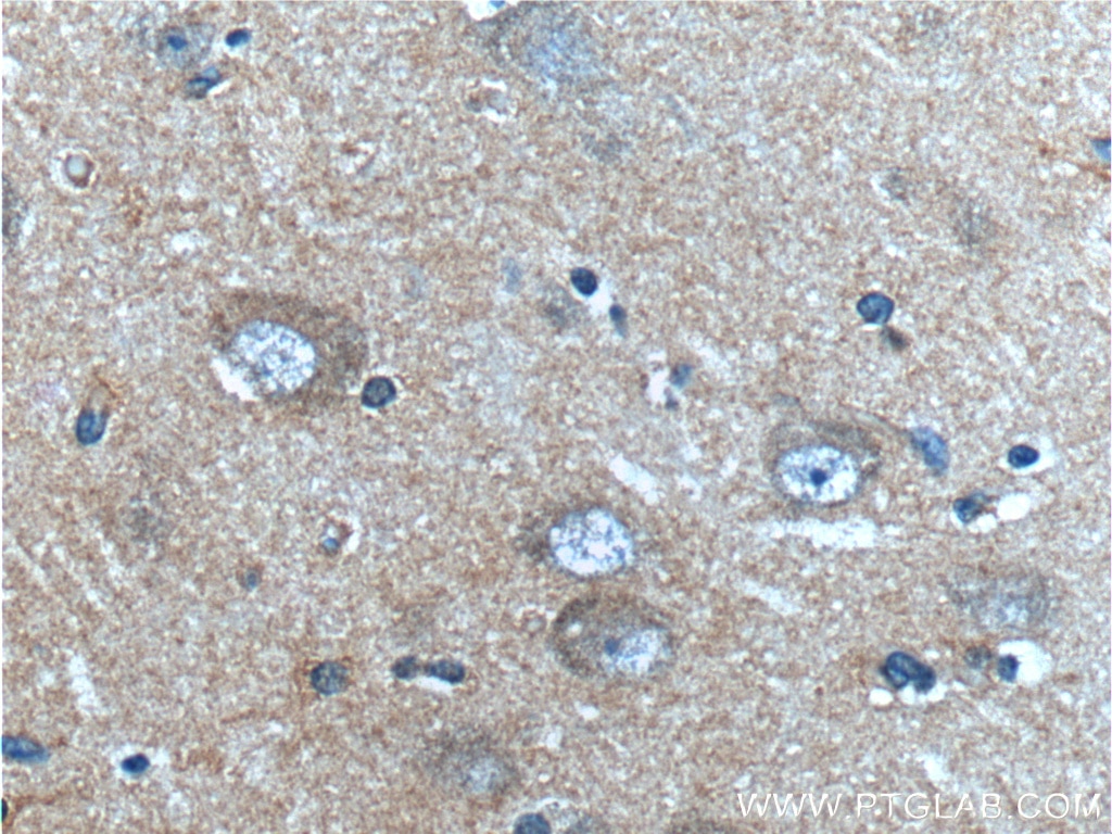 Immunohistochemistry (IHC) staining of human brain tissue using CXCR3B-specific Monoclonal antibody (60065-1-Ig)
