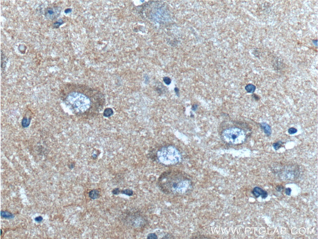 IHC staining of human brain using 60065-1-Ig