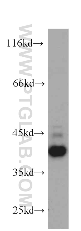 CXCR3B-specific Monoclonal antibody